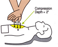 CPR Compressions