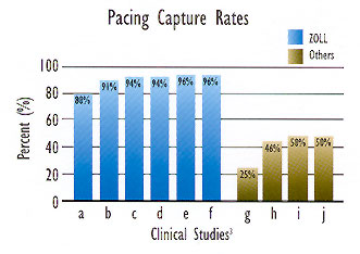 Pacing waveform comparison