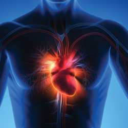 Myocarditis